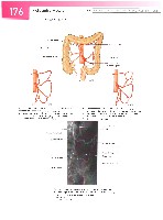 Sobotta  Atlas of Human Anatomy  Trunk, Viscera,Lower Limb Volume2 2006, page 183